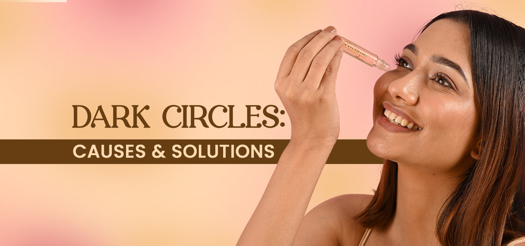 Dark Circles: Causes and Solutions